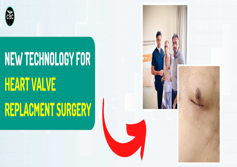 Heart Valve Replacement Surgery Cost in Delhi, India