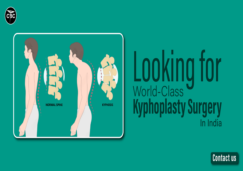 Kyphoplasty-Surgery