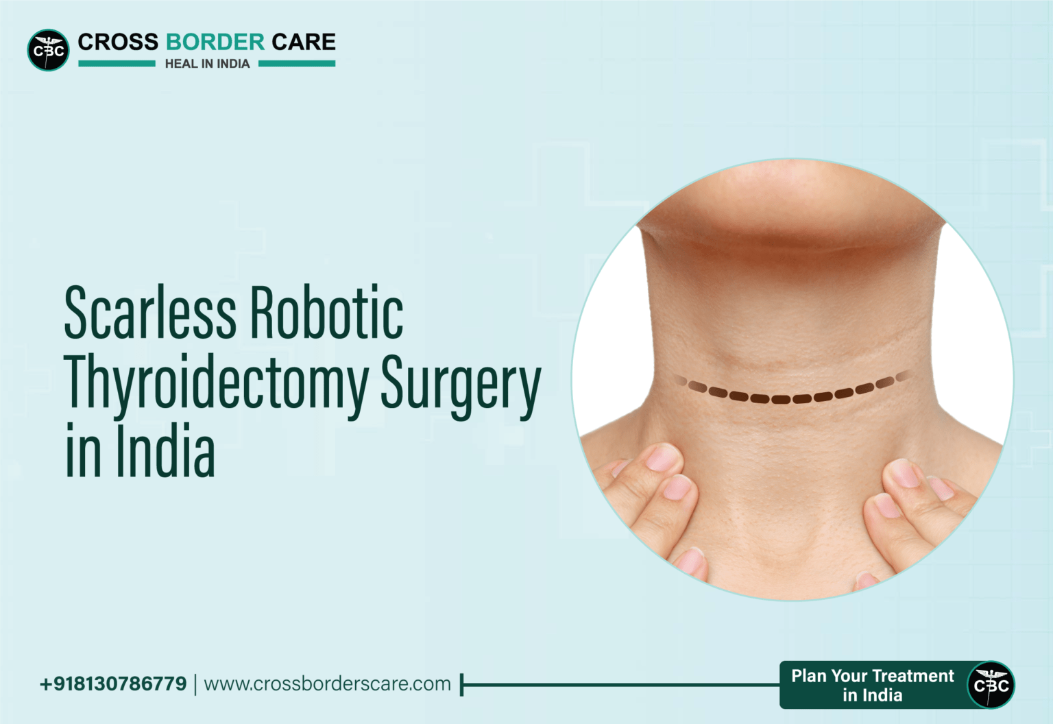 Scarless-Robotic-Thyroidectomy-Surgery