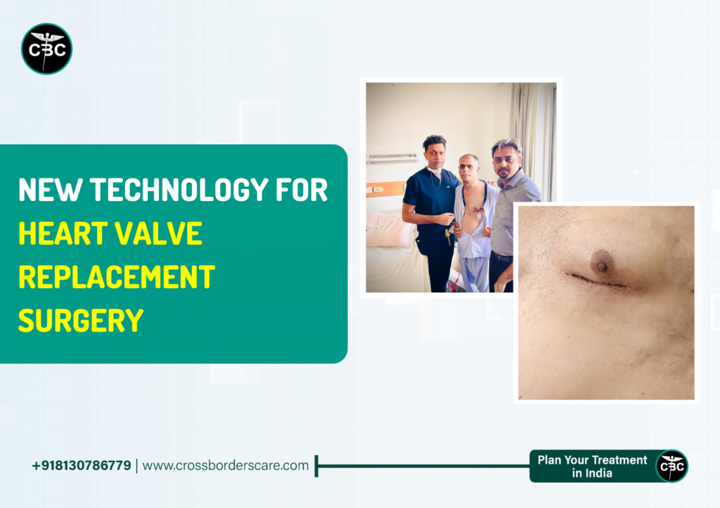 valve-replacement-surgery-and-its-cost