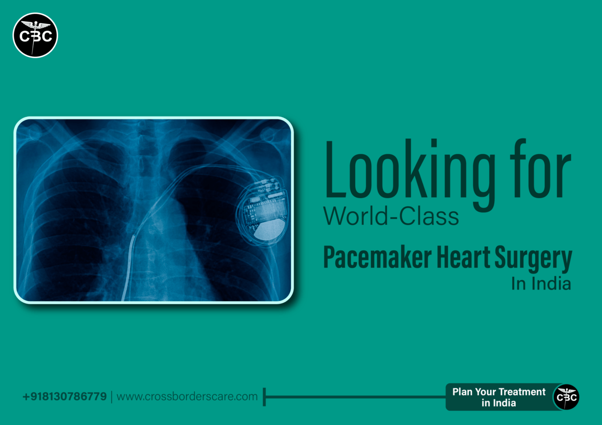 Pacemaker Implantation Surgery In India