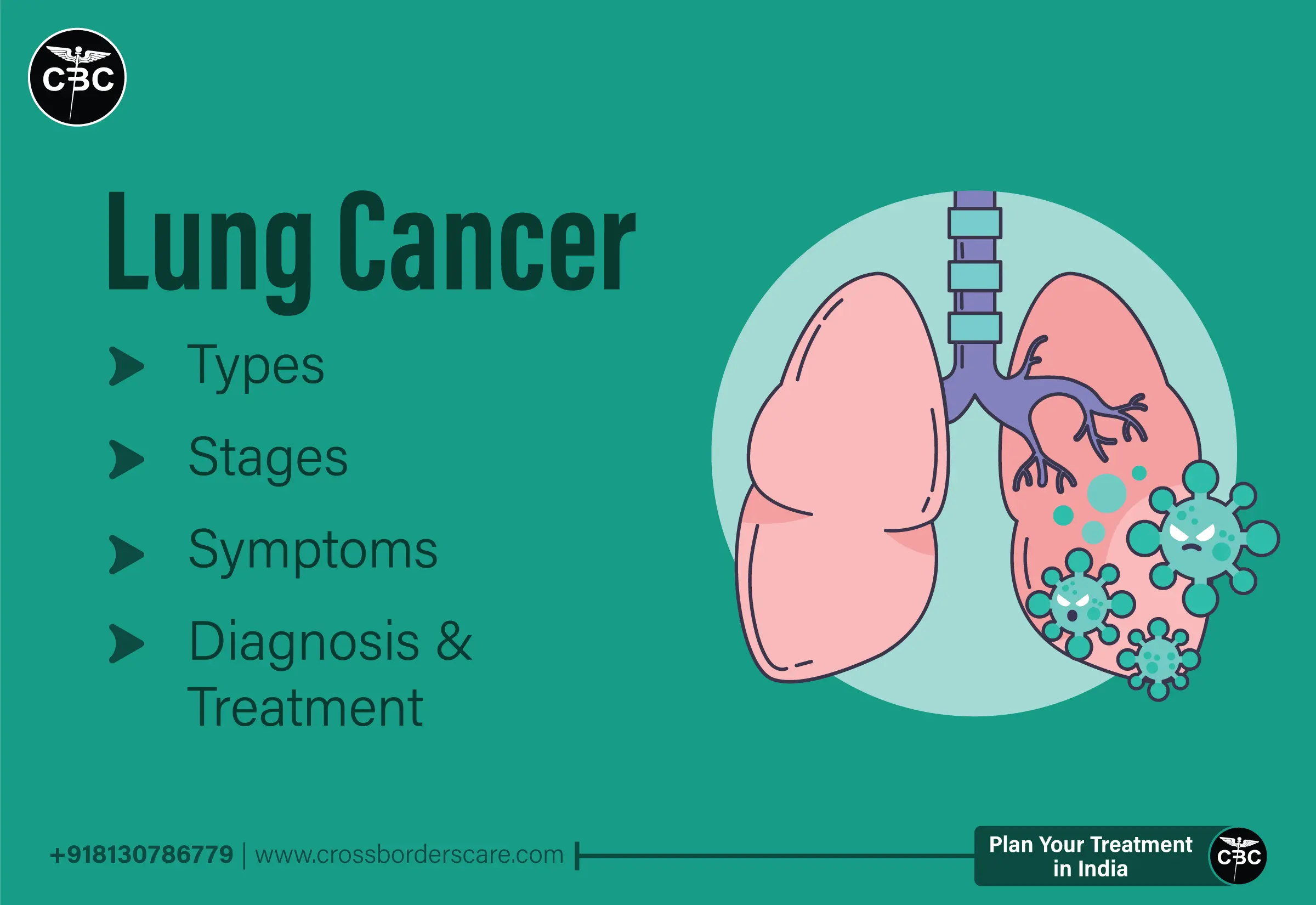 Lung Cancer - Types, Symptoms, Diagnosis and Treatment