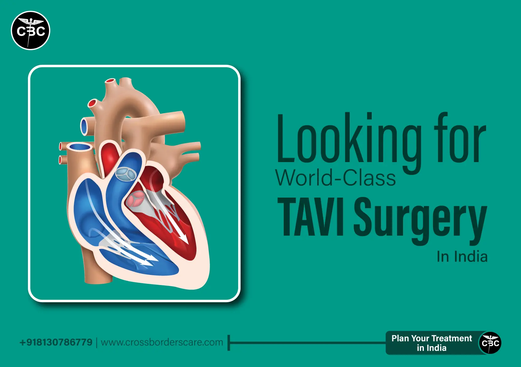 TAVI Surgery