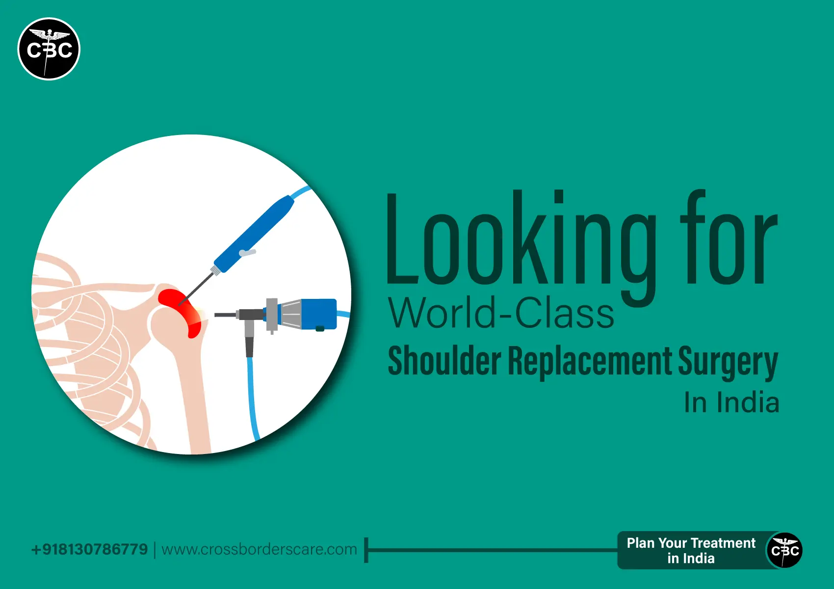 shoulder-replacement