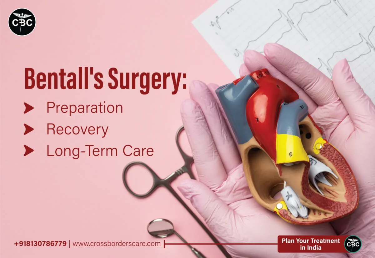 Bentall Procedure: Preparation, Recovery and Long-Term Care