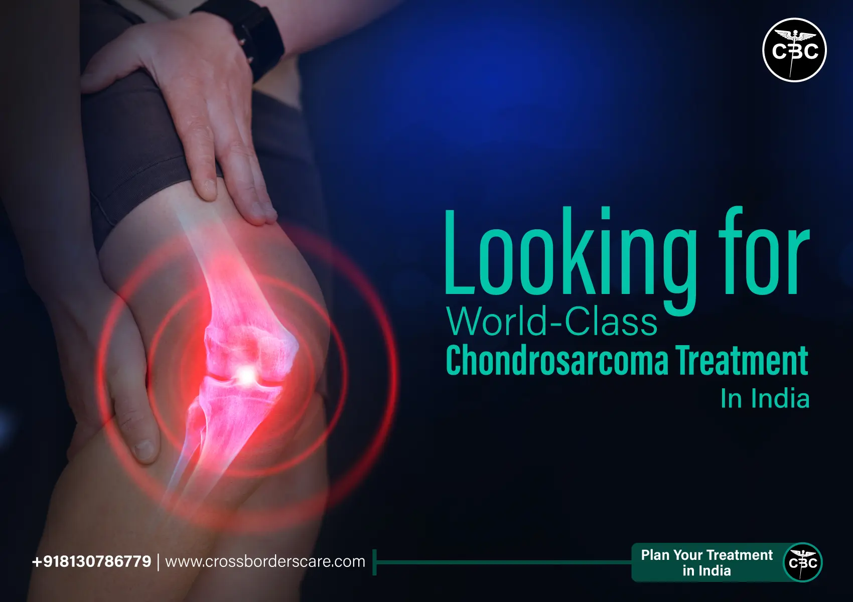 Chondrosarcoma-Treatment