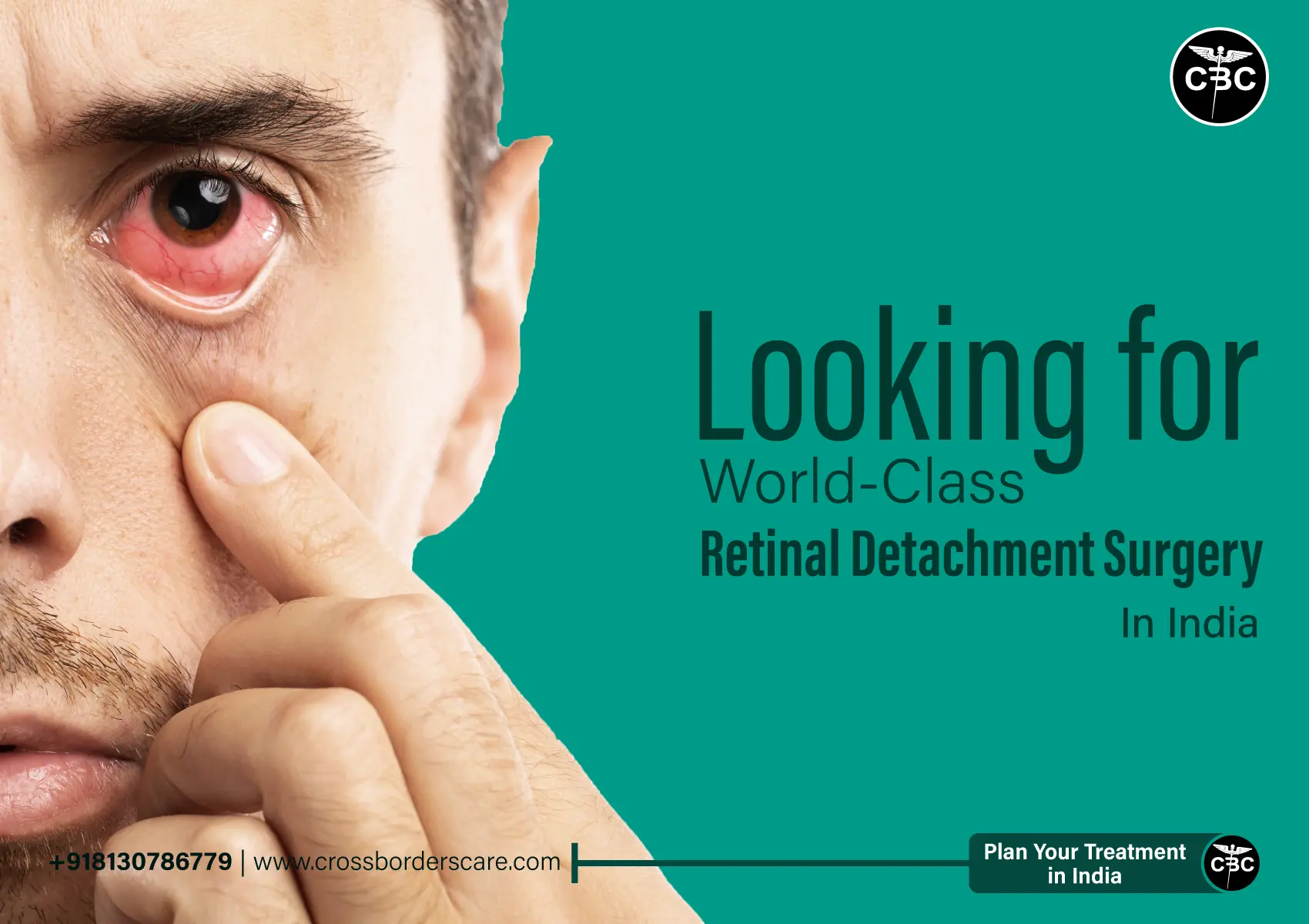Retinal-Detachment-Surgery