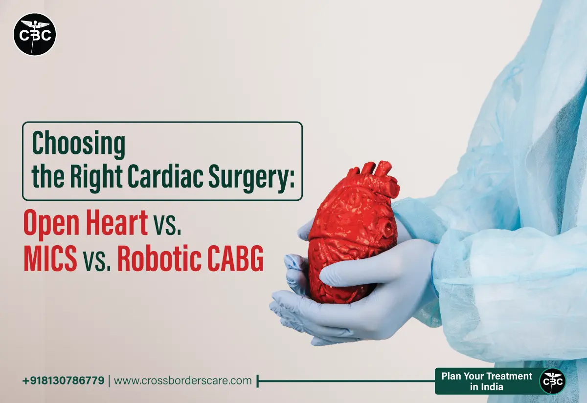 Choosing The Right Cardiac Surgery Open Heart Vs MICS Vs Robotic CABG   Choosing The Right Cardiac Surgery 1.webp