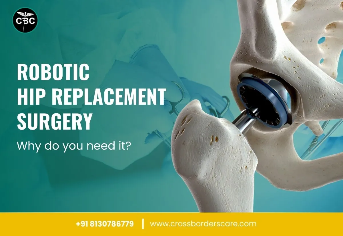 Robotic Hip Replacement Surgery