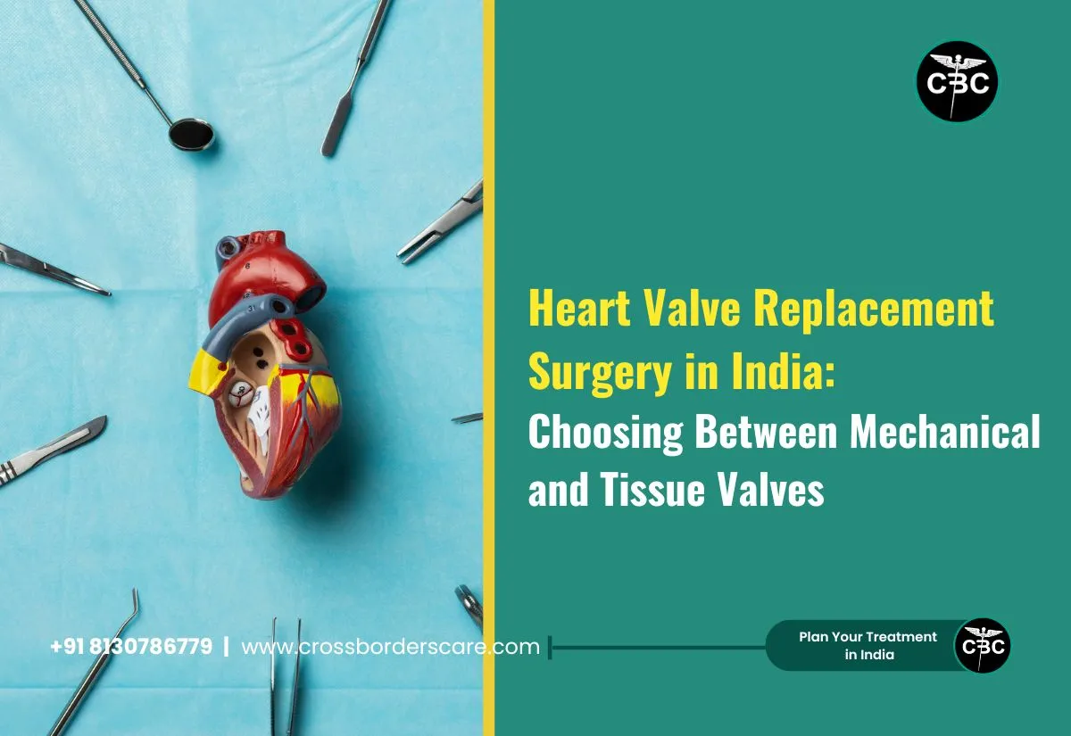 Heart Valve Replacement Surgery in India